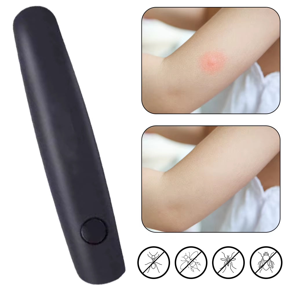 Electronic Reliever Bites Pen Relief Burning Pain & Swelling Itch Relief Tool Mosquito against Portable Tool for Summer