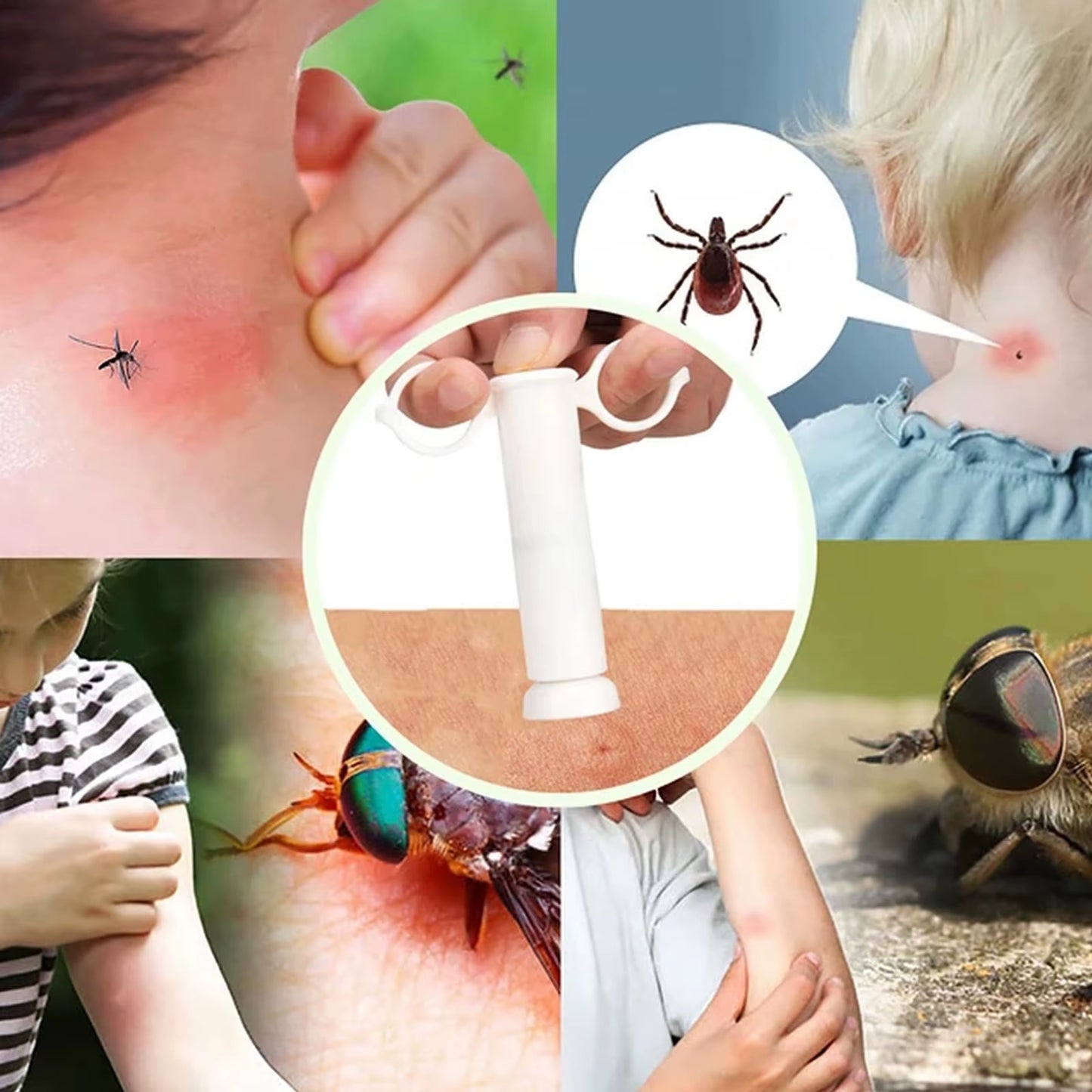 Suction Tool - Bug Bites and Bee/Wasp Stings Natural Insect Bite Relief Painless Bug Bite/Venom Extractor for Hiking